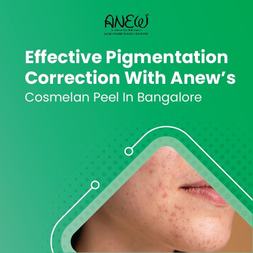  cosmelan peel in banashankari, bangalore